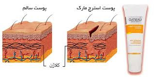 کرم رفع ترک های پوستی گاتیو ایتالیا 100 میل